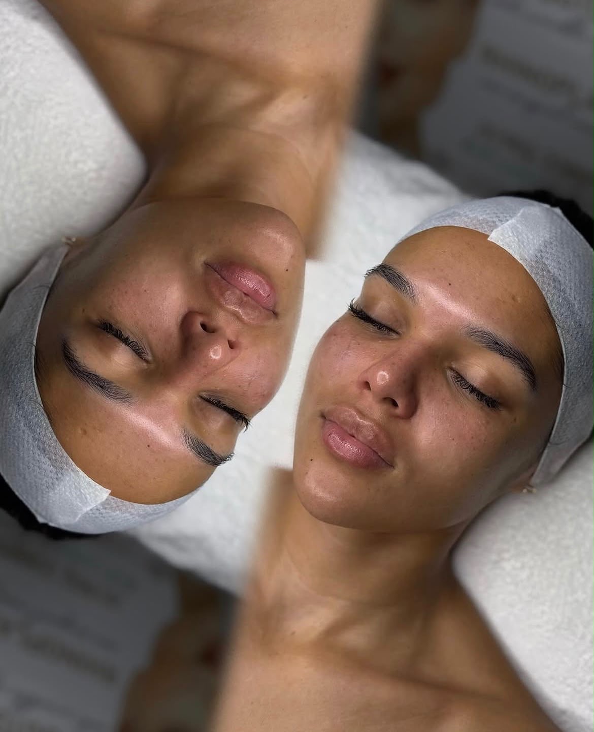 Skin rejuvenation result